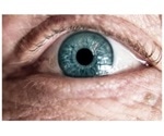 Alzheimer’s proteins linked to age-related vision loss