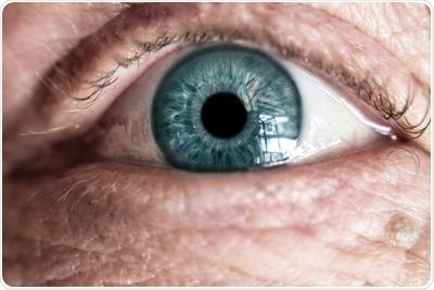 Alzheimer’s proteins linked to age-related vision loss