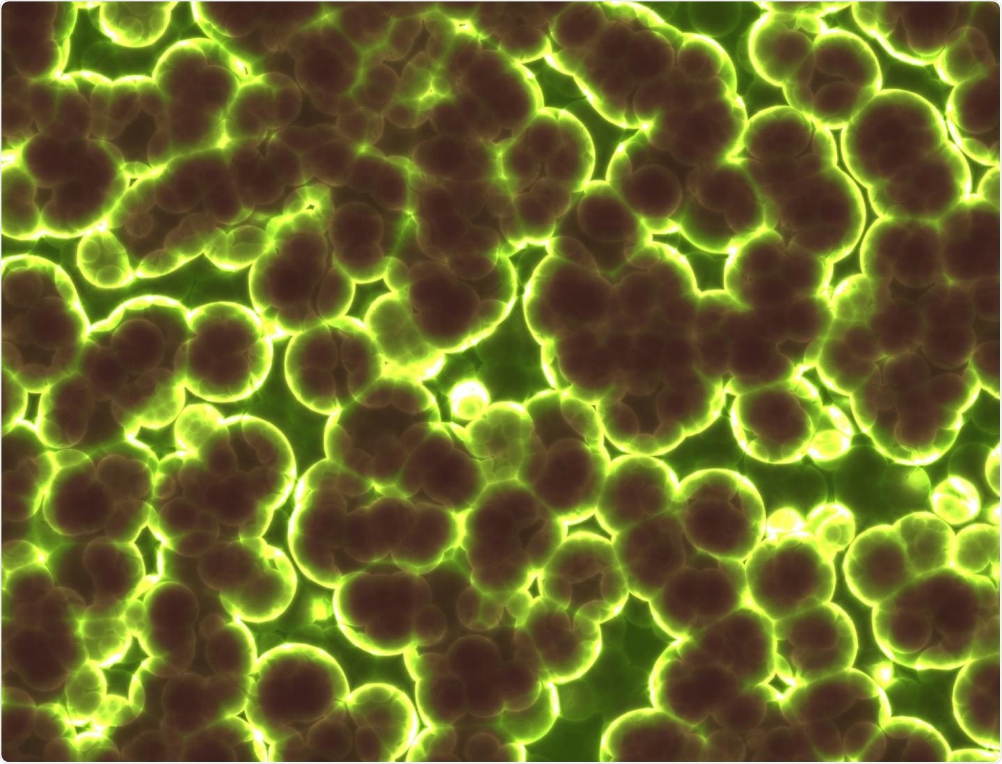 New models can optimize wastewater disinfection process, prevent spread of antibiotic resistance
