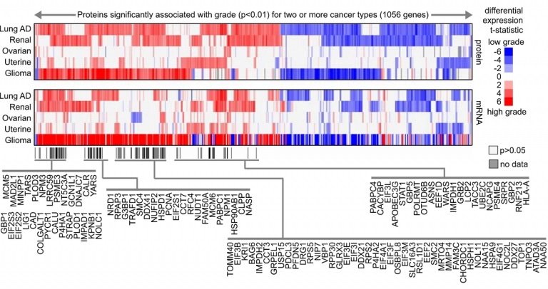 Promising drug targets identified for aggressive forms of cancers