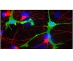 Experimental antibody therapies for neurodegenerative diseases may lead to brain inflammation