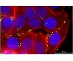 Key protein could block the most common cause of food poisoning