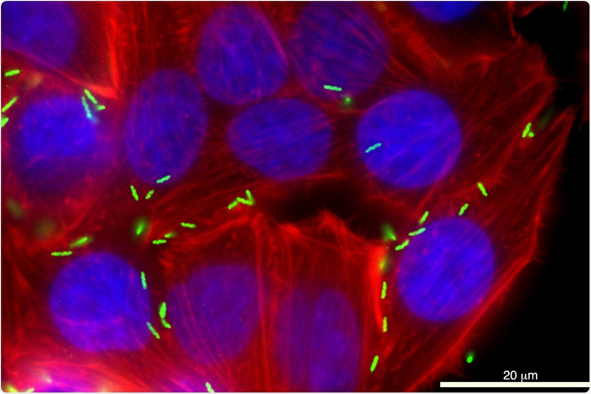 Key protein could block the most common cause of food poisoning