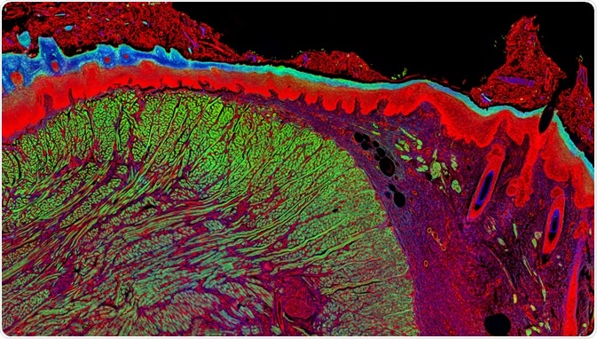 Fluorescence Microscopy Fluorescence Microscopy