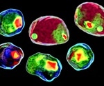 What is Flow Cytometry?