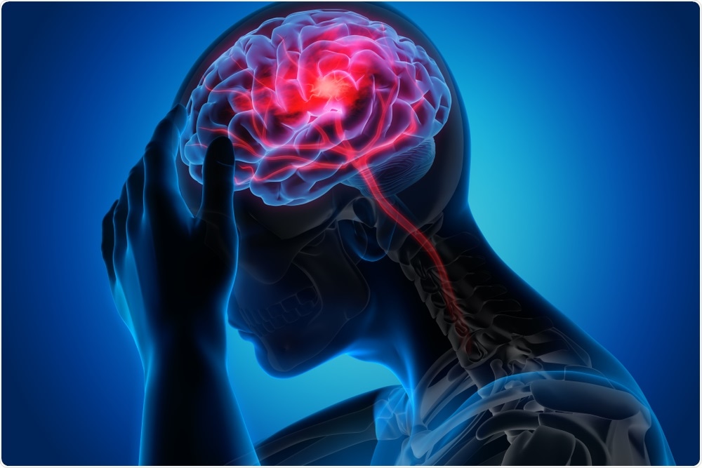 Stroke Concept Stroke Concept