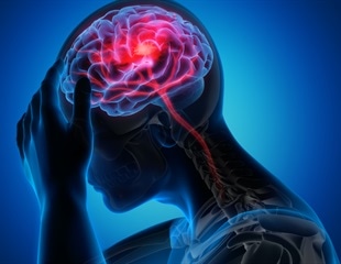 New genetic evidence points to novel therapies for “silent” stroke