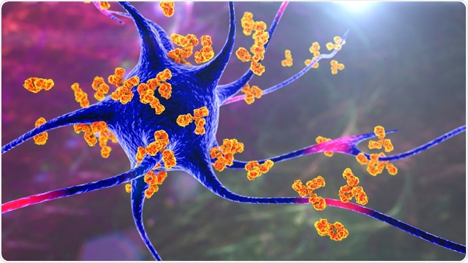 Autoimmune Disease Concept Autoimmune Disease Concept