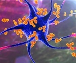 An Introduction to Autoimmunity