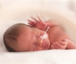 New technique can mitigate the effects of brain injury in preterm babies