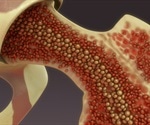 Regenerating bone marrow after chemotherapy
