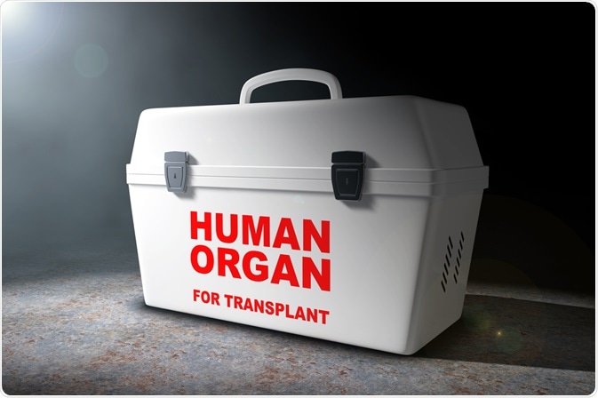 Organ Transplant