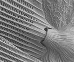 Scanning Electron Microscopy (SEM): An Overview