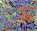 Using Electron Microscopy to Detect Viruses