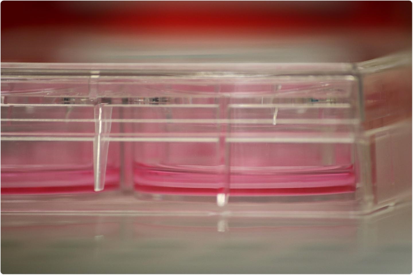 Study reveals SARS-CoV-2 spike protein can trigger long-term gene expression changes