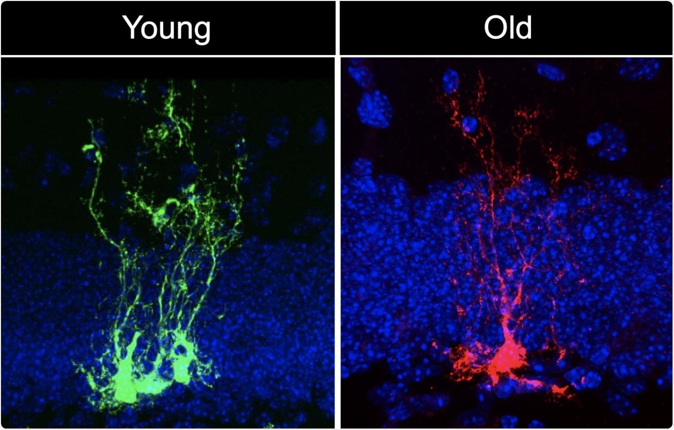 Study shows that neural stem cells age quickly