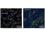 Study shows a possible link between pesticide exposure and increased COVID-19 susceptibility