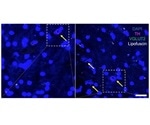 Study identifies single protein key to regulating sex differences in Parkinson’s disease