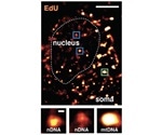 Study sheds new light on age-related neurodegenerative disorders