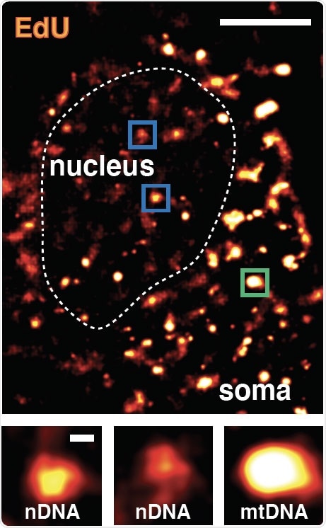 Study sheds new light on age-related neurodegenerative disorders Study sheds new light on age-related neurodegenerative disorders