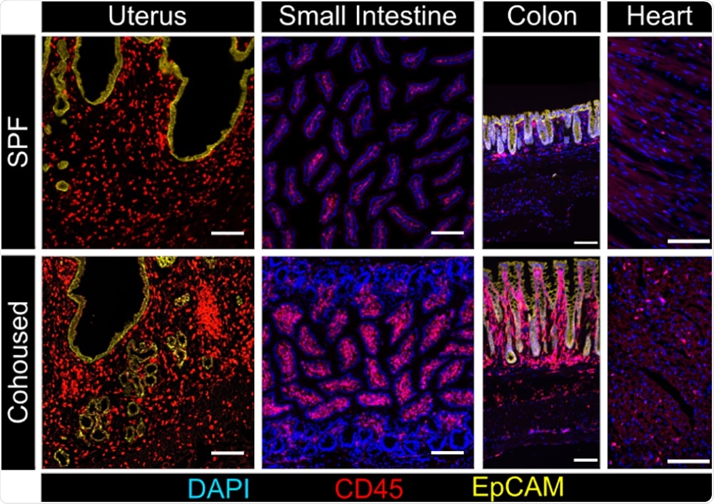 Study offers new ways to think about the immune system