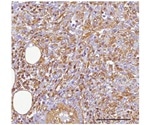 Study identifies a pair of microRNA molecules that maintain the population of cancerous stem cells
