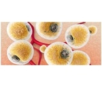 Obesity reduces mitochondrial gene expression in fat tissues