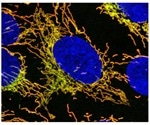 Study discovers that mutations in a specific gene cause mitochondrial disease