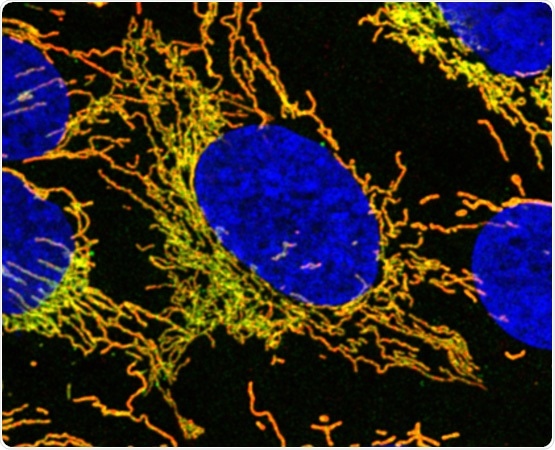 Study discovers that mutations in a specific gene cause mitochondrial disease