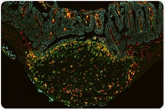 Study shows how stem cells make specific types of cells