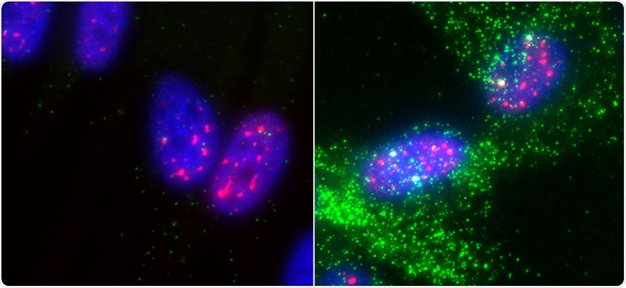 Tumor-inhibiting protein p53 boosts gene expression by bringing together nuclear speckles and DNA
