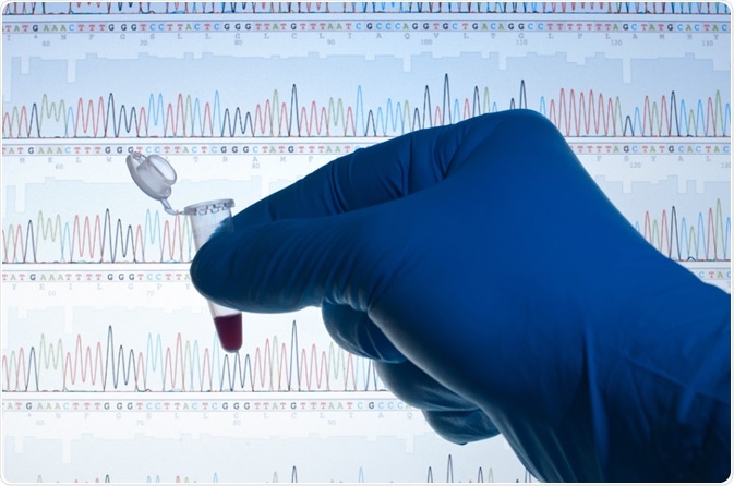 Forensic DNA Forensic DNA
