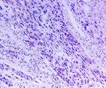 Study reveals how cells respond to changes in the mechanical microenvironment