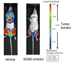 Study identifies new epigenetic control pathways in multiple myeloma growth