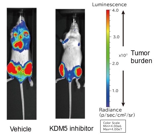 Study identifies new epigenetic control pathways in multiple myeloma growth