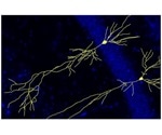 Researchers gain new insights into the physiological functions of APP protein