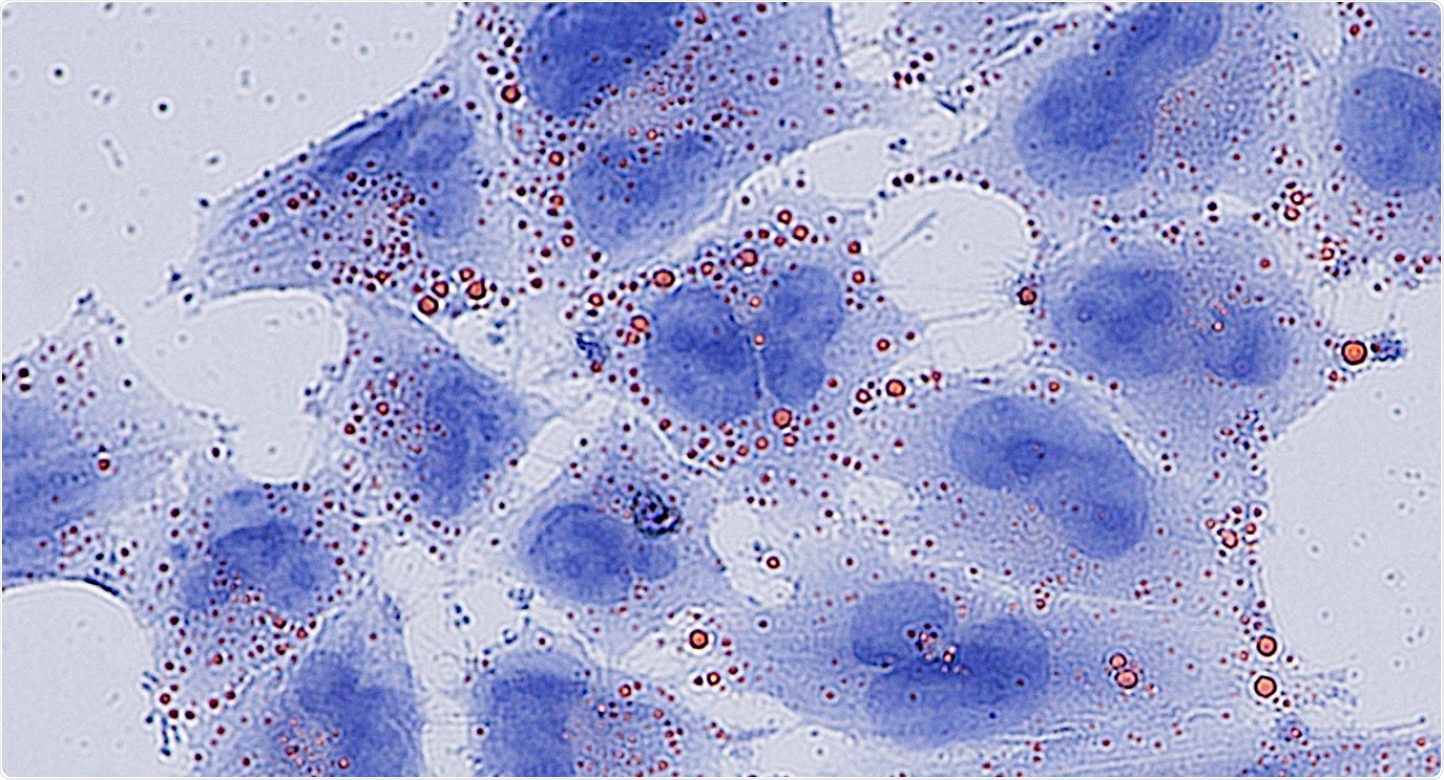 Study discovers novel function for metabolic enzyme medium-chain acyl-CoA dehydrogenase