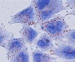 Study discovers novel function for metabolic enzyme medium-chain acyl-CoA dehydrogenase