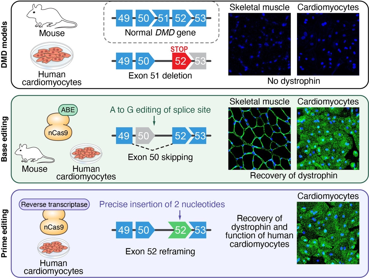 New gene therapy could help treat Duchenne muscular dystrophy