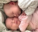 Abnormal fetal development is regulated by genetics, not the intrauterine environment