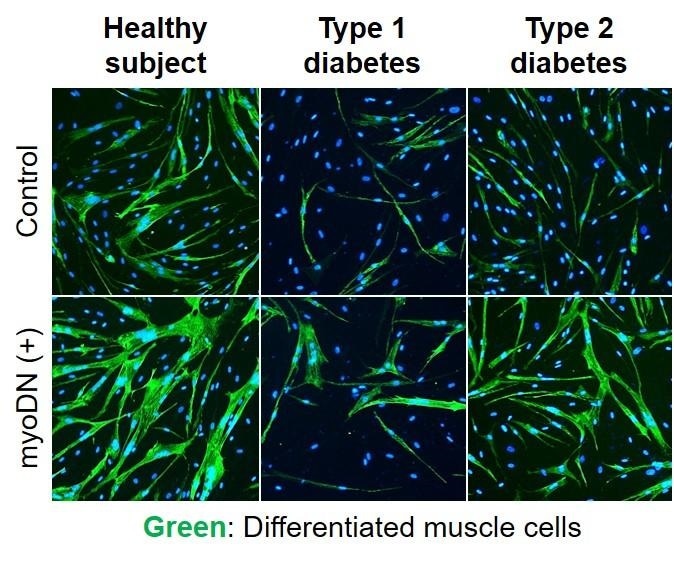 Study examines if myoDN improves myoblast differentiation exacerbated by diabetes