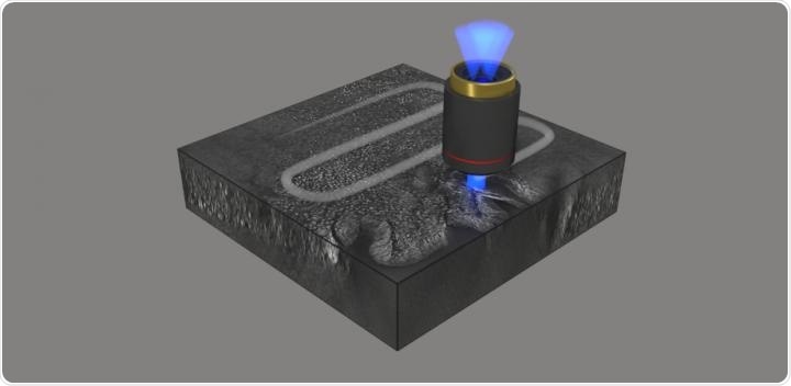 Holographic histopathology increases imaging speed, resolution for diagnostics