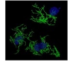 Gene expression signatures underlying microglia linked with amyloid plaque phagocytosis