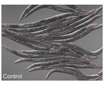 Worm cells sense metabolism changes to stimulate their defense against pathogens