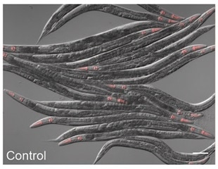 Worm cells sense metabolism changes to stimulate their defense against pathogens
