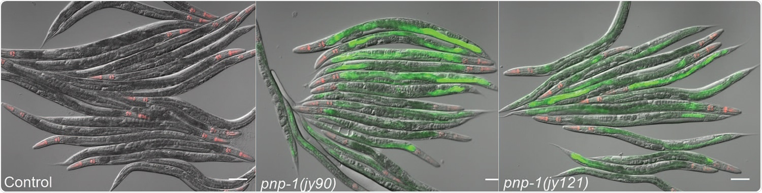 Worm cells sense metabolism changes to stimulate their defense against pathogens