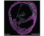 Human self-organizing cardiac organoids mimic the architecture of a heart chamber
