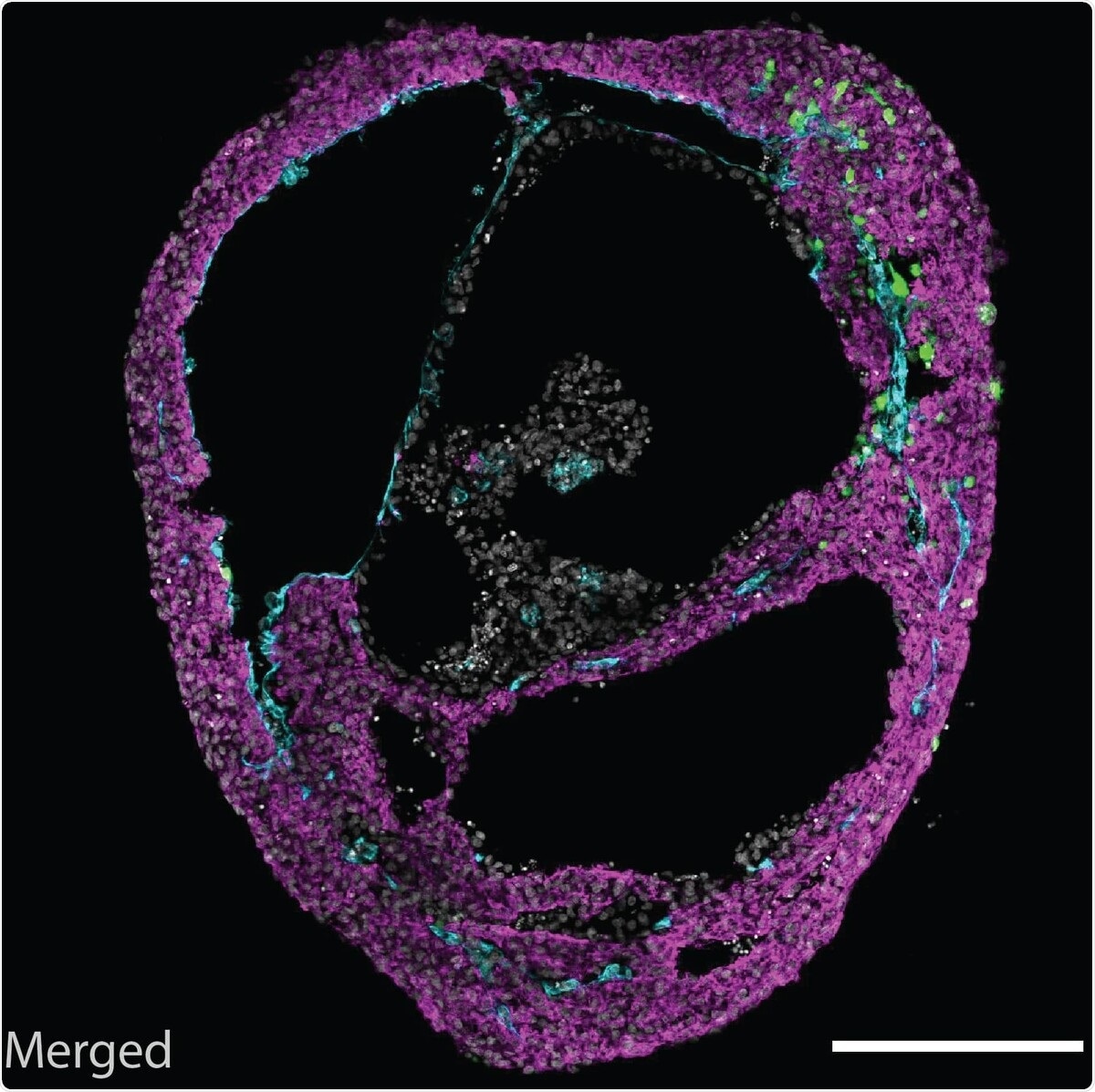 Human self-organizing cardiac organoids mimic the architecture of a heart chamber