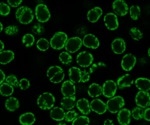 Researchers study the unique genomic organization of coral symbionts