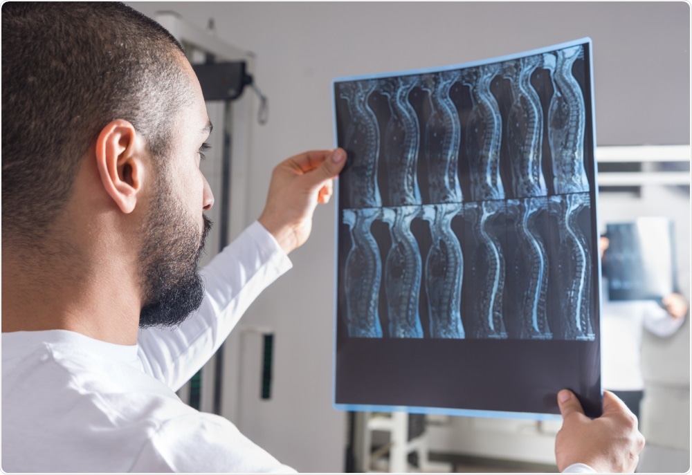 Spinal Cord Injury Spinal Cord Injury